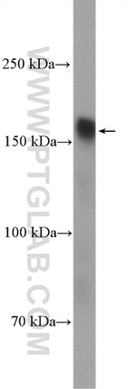 HDAC6 Antibody in Western Blot (WB)