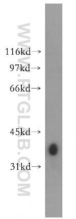 GYG1 Antibody in Western Blot (WB)