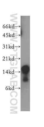 CD247 Antibody in Western Blot (WB)