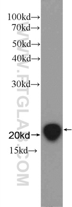 CD247 Antibody in Western Blot (WB)
