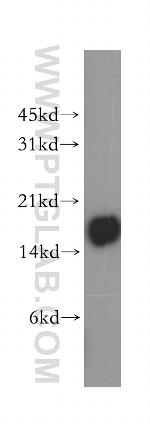 CD247 Antibody in Western Blot (WB)
