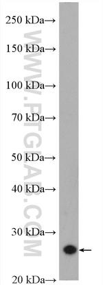 CENPH Antibody in Western Blot (WB)