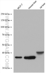 FBP1 Antibody in Western Blot (WB)