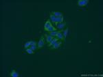 FBXO17 Antibody in Immunocytochemistry (ICC/IF)