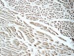 FBXO17 Antibody in Immunohistochemistry (Paraffin) (IHC (P))