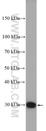 FBXO17 Antibody in Western Blot (WB)