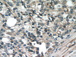 FBXO17 Antibody in Immunohistochemistry (Paraffin) (IHC (P))