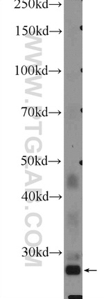 FBXO17 Antibody in Western Blot (WB)