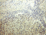 HS1BP3 Antibody in Immunohistochemistry (Paraffin) (IHC (P))