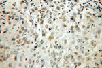 HS1BP3 Antibody in Immunohistochemistry (Paraffin) (IHC (P))