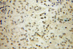 HS1BP3 Antibody in Immunohistochemistry (Paraffin) (IHC (P))