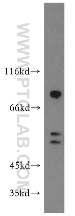 HS1BP3 Antibody in Western Blot (WB)