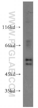 HS1BP3 Antibody in Western Blot (WB)