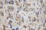 BCL2L14 Antibody in Immunohistochemistry (Paraffin) (IHC (P))