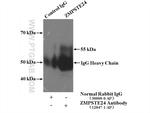 ZMPSTE24 Antibody in Immunoprecipitation (IP)