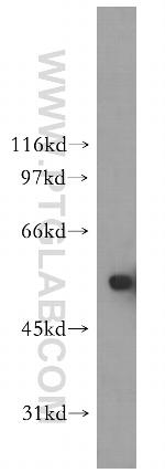 ZMPSTE24 Antibody in Western Blot (WB)