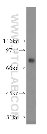 CMIP Antibody in Western Blot (WB)