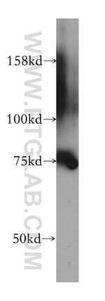 CMIP Antibody in Western Blot (WB)