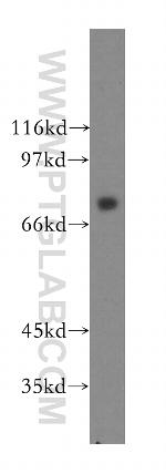 CMIP Antibody in Western Blot (WB)