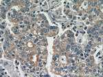 CTPS2 Antibody in Immunohistochemistry (Paraffin) (IHC (P))
