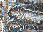 CTPS2 Antibody in Immunohistochemistry (Paraffin) (IHC (P))