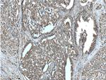 CTPS2 Antibody in Immunohistochemistry (Paraffin) (IHC (P))