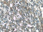 CTPS2 Antibody in Immunohistochemistry (Paraffin) (IHC (P))