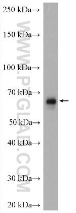 CTPS2 Antibody in Western Blot (WB)