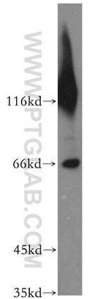 CTPS2 Antibody in Western Blot (WB)