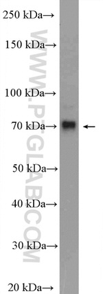 CTPS2 Antibody in Western Blot (WB)