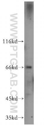 CTPS2 Antibody in Western Blot (WB)