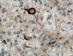 KGA/GAC Antibody in Immunohistochemistry (Paraffin) (IHC (P))