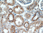 KGA/GAC Antibody in Immunohistochemistry (Paraffin) (IHC (P))