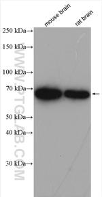 KGA/GAC Antibody in Western Blot (WB)