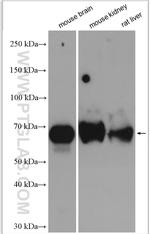 KGA/GAC Antibody in Western Blot (WB)