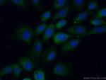 STK33 Antibody in Immunocytochemistry (ICC/IF)