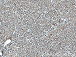 STK33 Antibody in Immunohistochemistry (Paraffin) (IHC (P))