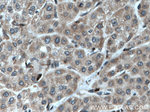 STK33 Antibody in Immunohistochemistry (Paraffin) (IHC (P))