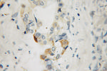STK33 Antibody in Immunohistochemistry (Paraffin) (IHC (P))