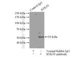 STK33 Antibody in Immunoprecipitation (IP)