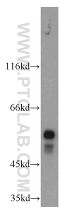STK33 Antibody in Western Blot (WB)