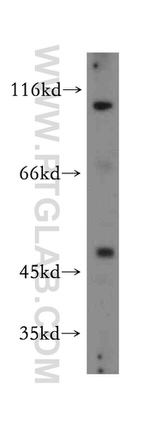 STK33 Antibody in Western Blot (WB)