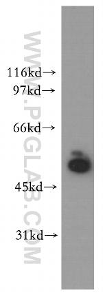 STK33 Antibody in Western Blot (WB)