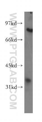 PHYH Antibody in Western Blot (WB)