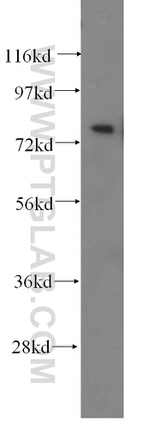 PHYH Antibody in Western Blot (WB)