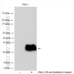 CCL3L1 Antibody in Western Blot (WB)