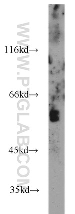 PAMCI Antibody in Western Blot (WB)