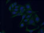 PAMCI Antibody in Immunocytochemistry (ICC/IF)