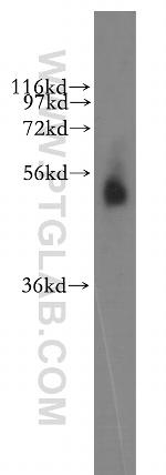 PAMCI Antibody in Western Blot (WB)