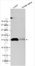 ALOX5AP Antibody in Western Blot (WB)